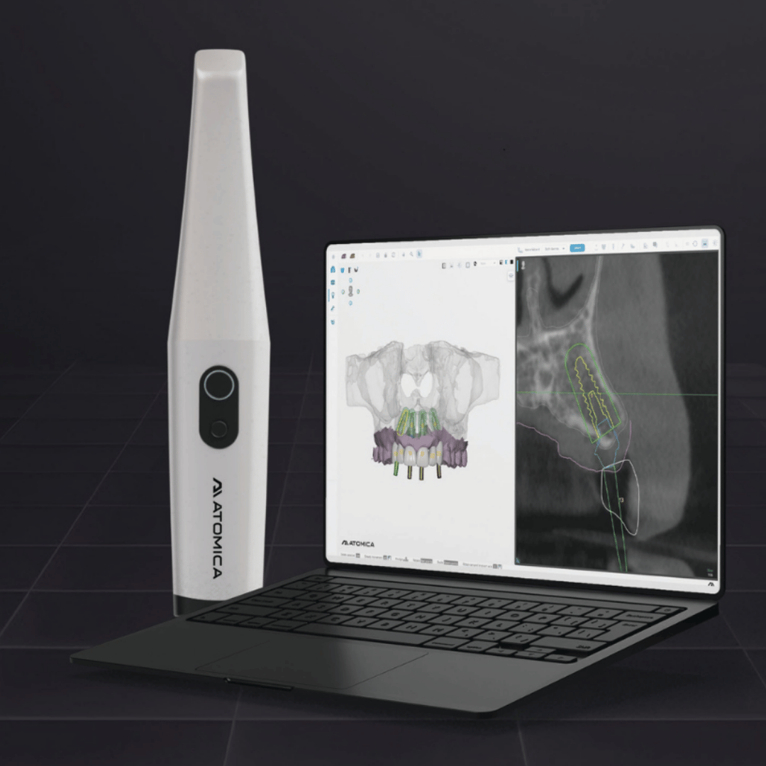 Atomica s300 intraoral sanner & software Atomica s300 intraoral sanner & software