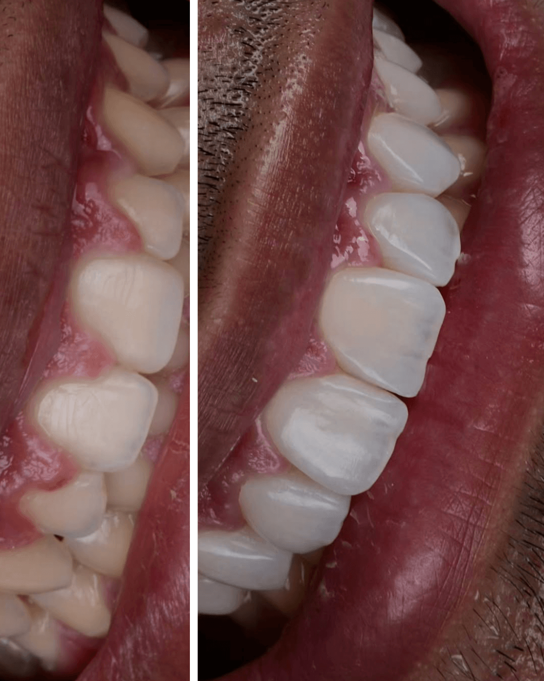 Dr Esra Uzer Celik Kulzer Course-2 Dr Esra Uzer Celik Kulzer Course-2